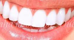 Các vấn đề răng miệng