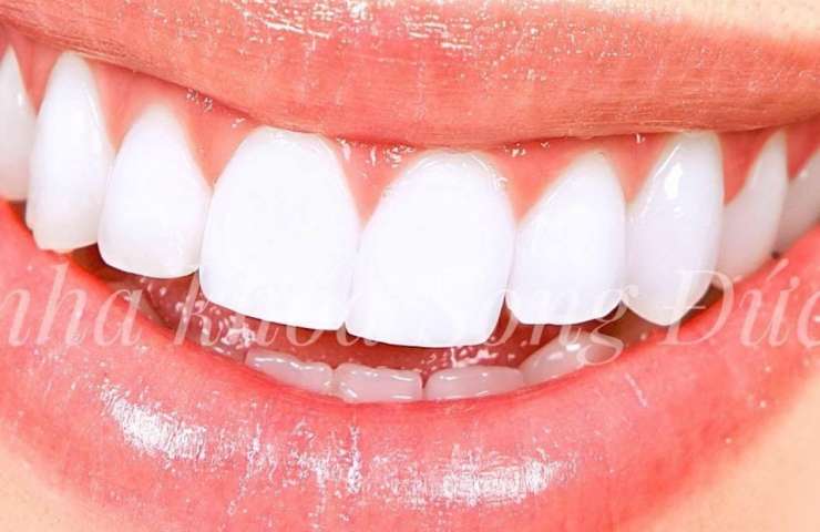Các vấn đề răng miệng